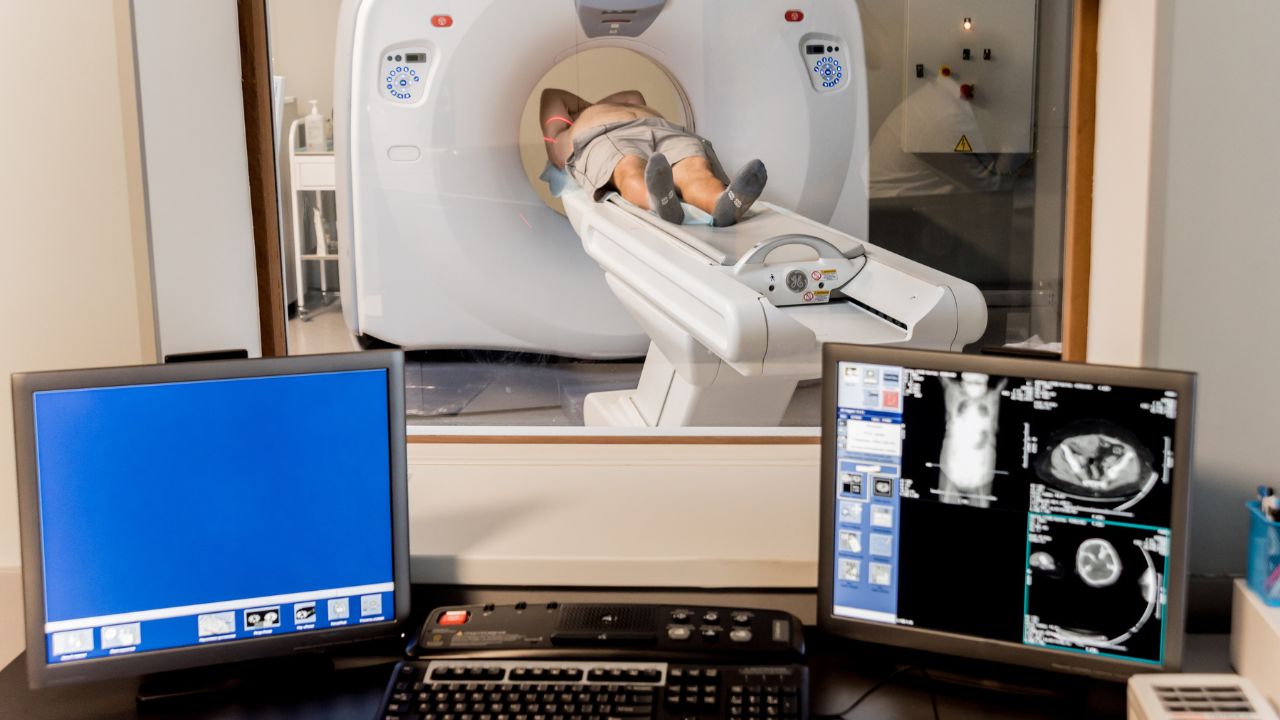 How Can I Share an MRI or a CT Scan A Comprehensive Guide - Presented by PostDICOM